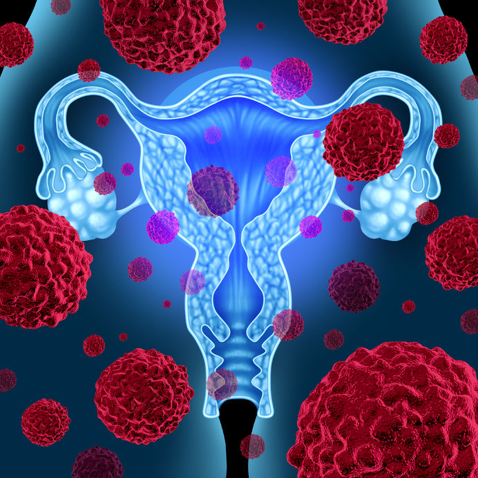 La dysplasie cervicale : des stratégies naturopathiques et conventionnelles